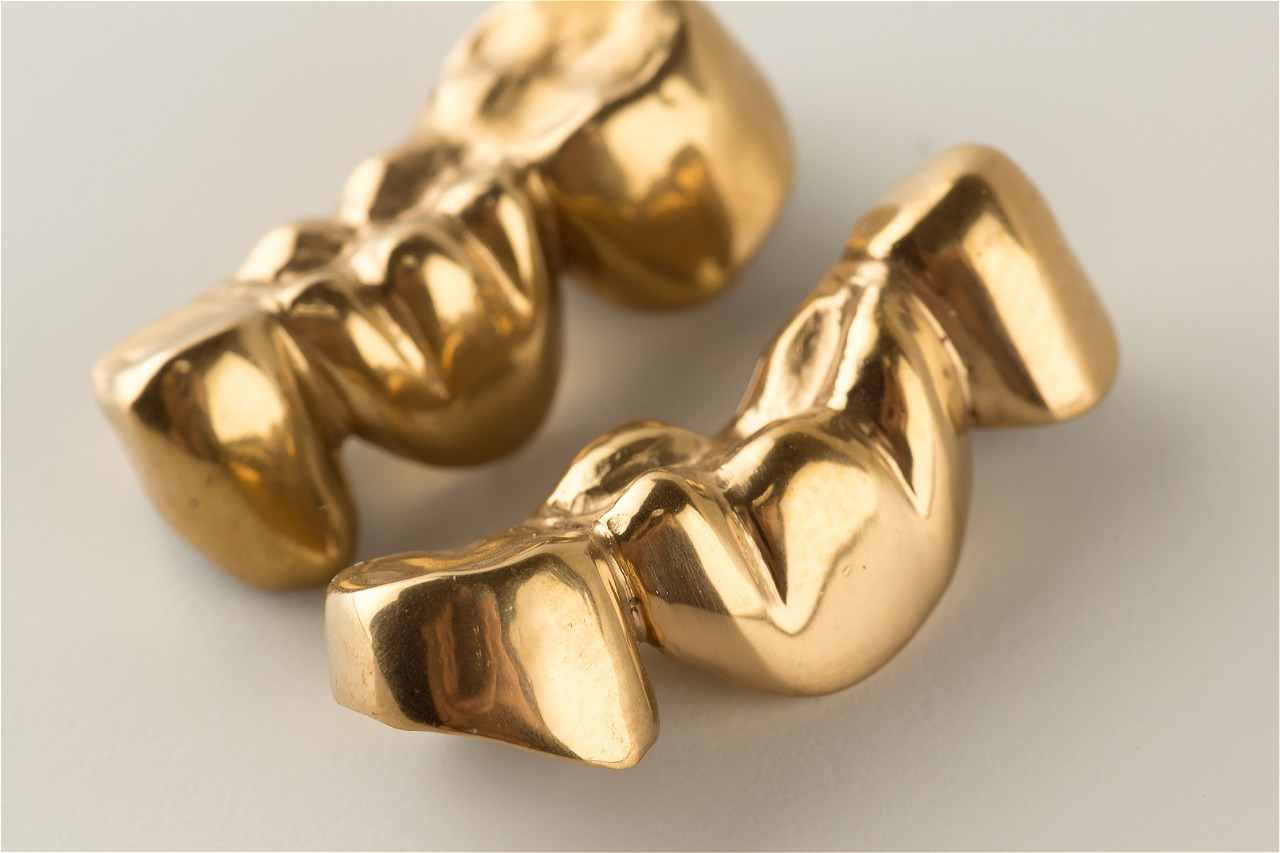 Goldene Zähne
